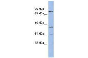 Image no. 1 for anti-Oleoyl-ACP Hydrolase (OLAH) (AA 35-84) antibody (ABIN6744029) (OLAH antibody  (AA 35-84))