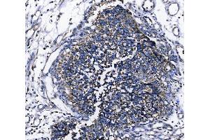 IHC analysis of TOMM70 using anti-TOMM70 antibody (ABIN7599855). (TOM70 antibody  (AA 122-608))