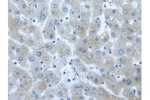 Detection of DVL1 in Human Liver Tissue using Polyclonal Antibody to Dishevelled, Dsh Homolog 1 (DVL1) (DVL1 antibody  (AA 150-285))