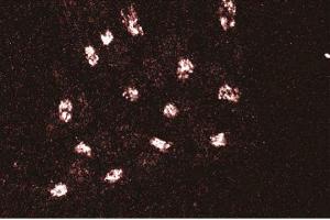 Immunofluorescent staining of HeLa cells with anti-GMAP-210. (Thyroid Hormone Receptor Interactor 11 (TRIP11) (AA 159-365) antibody)