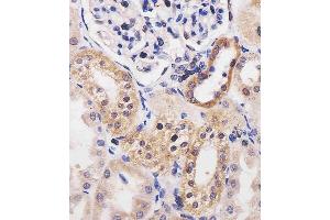 (ABIN6242147 and ABIN6577254) staining ADK in human kidney tissue sections by Immunohistochemistry (IHC-P - paraformaldehyde-fixed, paraffin-embedded sections). (ADK antibody  (AA 1-345))