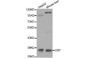 Western Blotting (WB) image for anti-C-Reactive Protein (CRP) (AA 1-224) antibody (ABIN3020716) (CRP antibody  (AA 1-224))