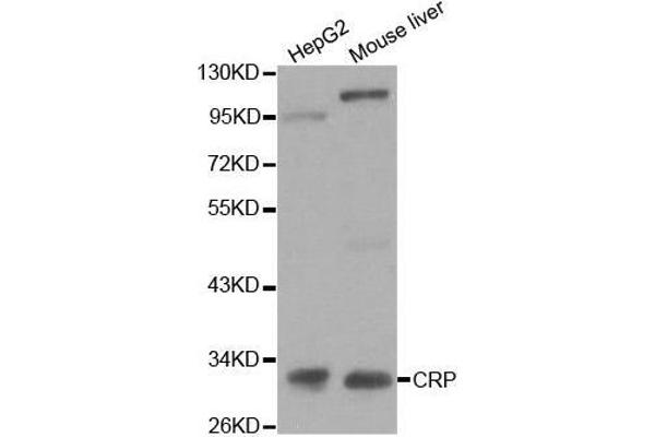 CRP 抗体  (AA 1-224)