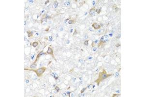 Immunohistochemistry of paraffin-embedded rat brain using IL22 antibody (ABIN5975407) at dilution of 1/100 (40x lens).