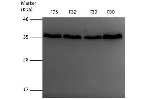 WB Image Sample (30 ug of whole cell lysate) A: A431 , 12% SDS PAGE VDAC1 antibody antibody diluted at 1:1000