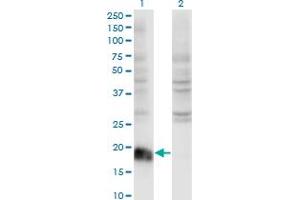 Western Blot analysis of ARF6 expression in transfected 293T cell line by ARF6 monoclonal antibody (M01A), clone 2A4. (ARF6 antibody  (AA 1-175))