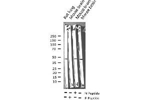 Western blot analysis of Phospho-MEK1/2 (Ser217) expression in various lysates (MEK1 antibody  (pSer217))