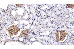 Detection of PODXL in Rat Kidney Tissue using Polyclonal Antibody to Podocalyxin (PODXL) (PODXL antibody  (AA 408-485))