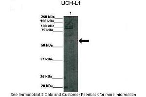 Lanes:   Lane 1: 75,000 rat INS1 cells  Primary Antibody Dilution:    1:1000  Secondary Antibody:   Anti rabbit-HRP  Secondary Antibody Dilution:    1:1000  Gene Name:   DGCR2  Submitted by:   Benedich Bracleva, VUB, Universitair Ziekenhuis Brussel (DGCR2 antibody  (Middle Region))