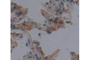 IHC-P analysis of Human Tissue, with DAB staining. (Peroxiredoxin 3 antibody  (AA 5-233))