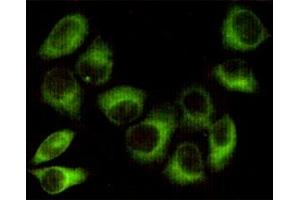 Immunocytochemistry staining of HeLa cells fixed with 1 % Paraformaldehyde and using PK beta 1 mouse mAb (dilution 1:100). (PRKAB1 antibody)