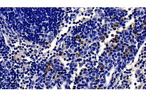 Immunohistochemistry (IHC) image for anti-Toll-Like Receptor 4 (TLR4) (AA 49-247) antibody (ABIN7432529)