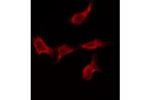 ABIN6275577 staining Hela by IF/ICC. (SCN4A antibody  (Internal Region))