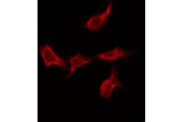 SCN4A anticorps  (Internal Region)