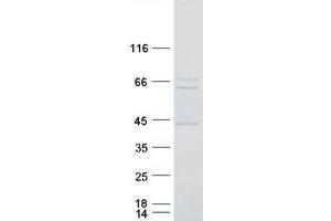 Validation with Western Blot