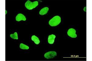 Immunofluorescence of monoclonal antibody to HMGB1 on HeLa cell. (HMGB1 antibody  (AA 1-215))