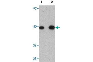 Western blot analysis of rat lung tissue with TMEM184B polyclonal antibody  at (Lane 1) 1 and (Lane 2) 2 ug/mL dilution. (TMEM184B antibody  (C-Term))