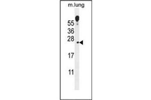 Western blot analysis of VOPP1 Antibody (Center) in mouse lung tissue lysates (35ug/lane). (VOPP1 antibody  (Middle Region))