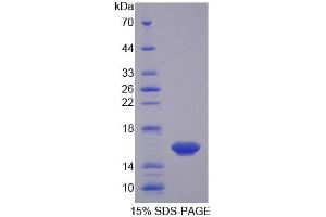 SDS-PAGE (SDS) image for Osteoglycin (OGN) (AA 180-298) protein (His tag) (ABIN1171074) (OGN Protein (AA 180-298) (His tag))