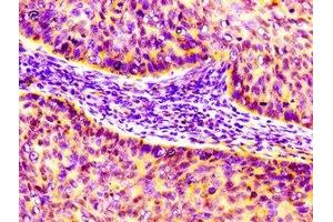 CCL17 antibody  (AA 24-94)