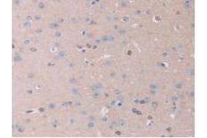 IHC-P analysis of Mouse Brain Tissue, with DAB staining. (IL13RA2 antibody  (AA 228-338))