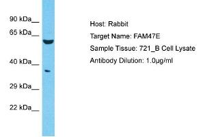 Host: Rabbit Target Name: FAM47E Sample Type: 721_B Whole Cell lysates Antibody Dilution: 1. (FAM47E antibody  (C-Term))