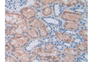 DAB staining on IHC-P; Samples: Human Kidney Tissue (ALDH7A1 antibody  (AA 1-539))