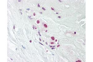 Anti-DPPA4 antibody IHC of human placenta. (DPPA4 antibody  (AA 1-50))
