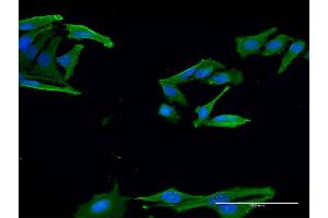 Immunofluorescence of monoclonal antibody to EN2 on HeLa cell. (EN2 antibody  (AA 86-210))