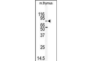 Western blot analysis of anti-EMK Antibody in mouse thymus tissue lysates (35ug/lane)