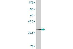 Western Blot detection against Immunogen (33. (BTBD9 antibody  (AA 2-70))