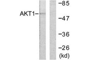 Western blot analysis of extracts from HeLa cells, treated with Etoposide 25uM 24h, using Akt (Ab-246) Antibody. (AKT1 antibody  (AA 212-261))