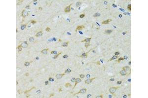 Immunohistochemistry of paraffin-embedded Rat brain using DCTN2 Polyclonal Antibody at dilution of 1:100 (40x lens). (Dynamitin antibody)