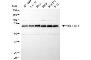 anti-KH Domain Containing, RNA Binding, Signal Transduction Associated 1 (KHDRBS1) antibody