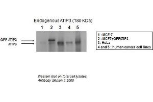 MTUS1 antibody - middle region  validated by WB using MCF-7, HeLa, and human cancer cell lines at 1:2000. (MTUS1 antibody  (Middle Region))