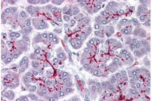 Human Pancreas: Formalin-Fixed, Paraffin-Embedded (FFPE) (SLAIN1 antibody  (C-Term))