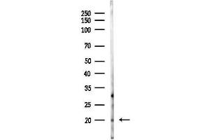 anti-RAS-Like, Family 10, Member B (Rasl10b) (Internal Region) antibody