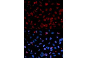 Immunofluorescence analysis of U2OS cell using SFRS1 antibody. (SRSF1 antibody  (pSer1))