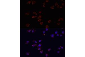Immunofluorescence analysis of HeLa cells using  antibody (ABIN3021237, ABIN3021238, ABIN3021239 and ABIN6214079) at dilution of 1:100. (ARF6 antibody  (AA 1-175))