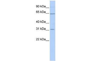 SLC27A2 antibody used at 1 ug/ml to detect target protein. (SLC27A2 antibody)