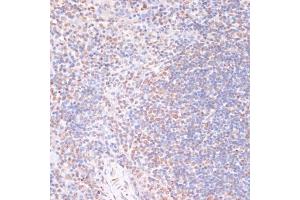 Immunohistochemistry of paraffin-embedded mouse spleen using Phospho-RPS6K-S376 antibody (ABIN7270039) at dilution of 1:100 (40x lens). (MSK1 antibody  (pSer376))