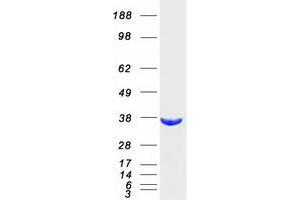 Validation with Western Blot (AKR1B10 Protein (Myc-DYKDDDDK Tag))