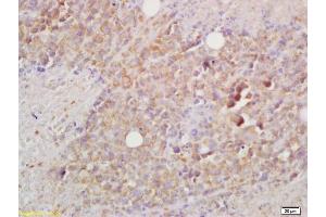 Formalin-fixed and paraffin embedded mouse lymphoma labeled with Rabbit Anti BCMA/CD269 Polyclonal Antibody, Unconjugated (ABIN705041) at 1:200 followed by conjugation to the secondary antibody and DAB staining (BCMA antibody  (AA 12-110))