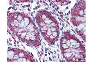 PGLS antibody was used for immunohistochemistry at a concentration of 4-8 ug/ml. (PGLS antibody  (Middle Region))