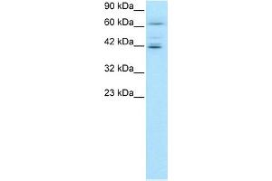 WB Suggested Anti-ETV6 Antibody Titration:  0. (ETV6 antibody  (C-Term))
