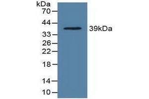 Detection of Recombinant LDHC, Rat using Polyclonal Antibody to Lactate Dehydrogenase C (LDHC) (Lactate Dehydrogenase C antibody  (AA 1-332))