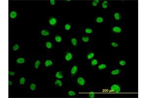 Immunofluorescence of monoclonal antibody to MYNN on HeLa cell.