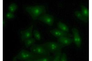 Detection of VAPB in Human Hela Cell using Polyclonal Antibody to Vesicle Associated Membrane Protein Associated Protein B (VAPB) (VAPB antibody  (AA 1-132))