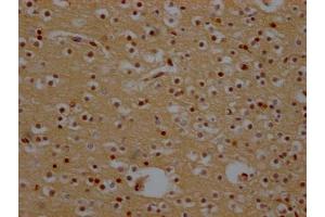 IHC image of ABIN7127436 diluted at 1:100 and staining in paraffin-embedded human brain tissue performed on a Leica BondTM system. (Recombinant XPO1 antibody)