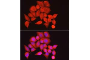 Immunofluorescence analysis of HeLa cells using PPP1R12A Rabbit pAb (ABIN6128260, ABIN6146059, ABIN6146061 and ABIN6213896) at dilution of 1:100 (40x lens). (PPP1R12A antibody  (AA 1-200))